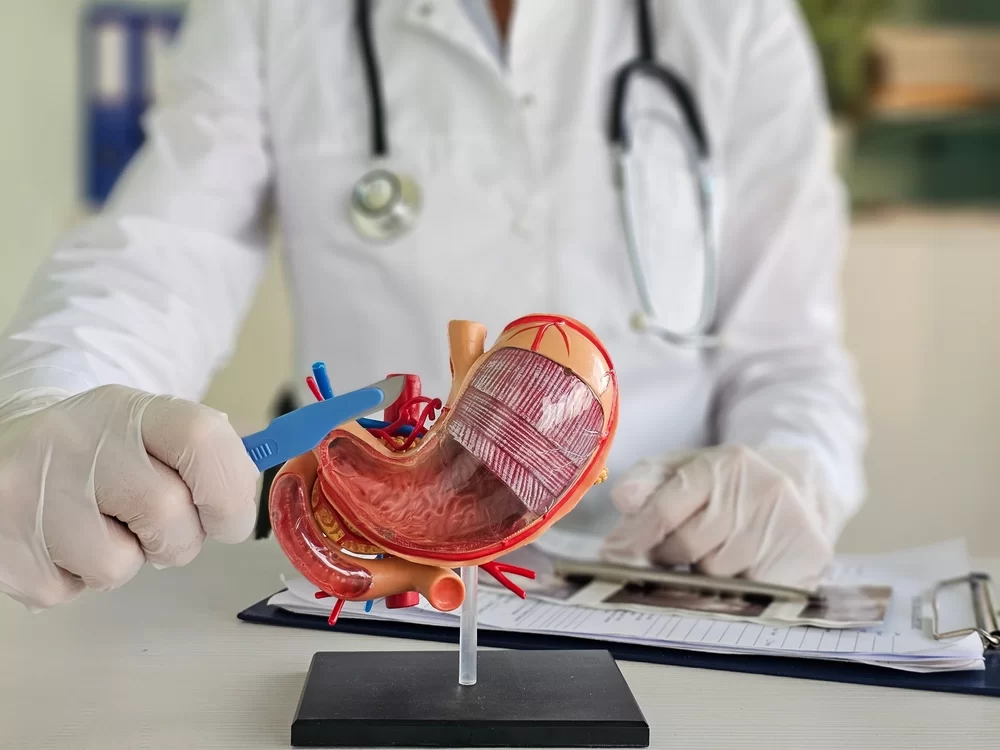 Bariatric Surgery